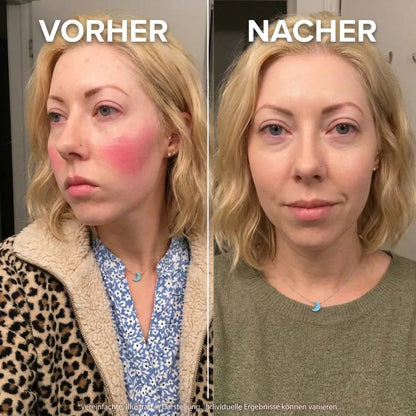 Stoppt Rötungen an der Ursache
