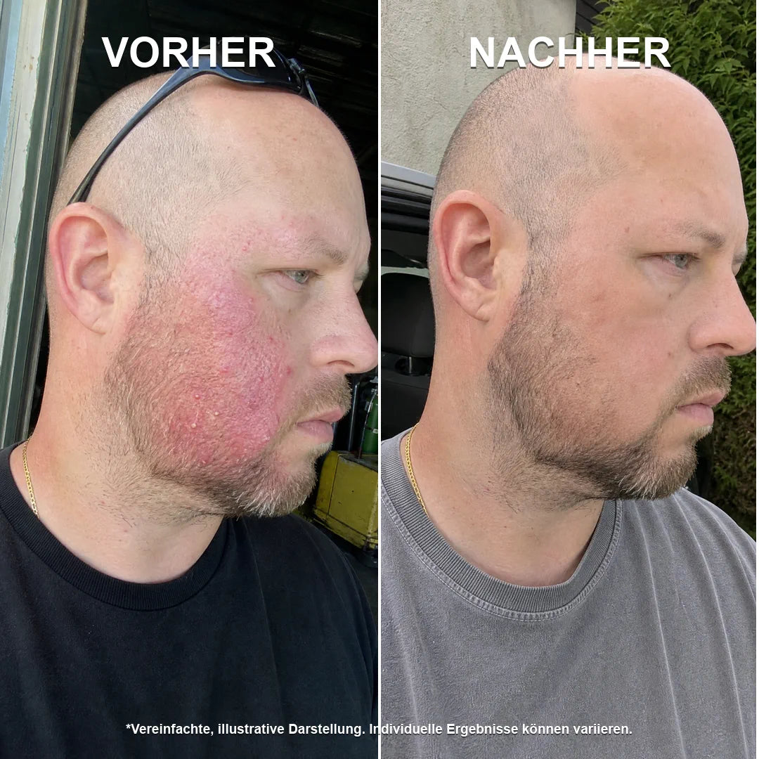 Stoppt Rötungen an der Ursache