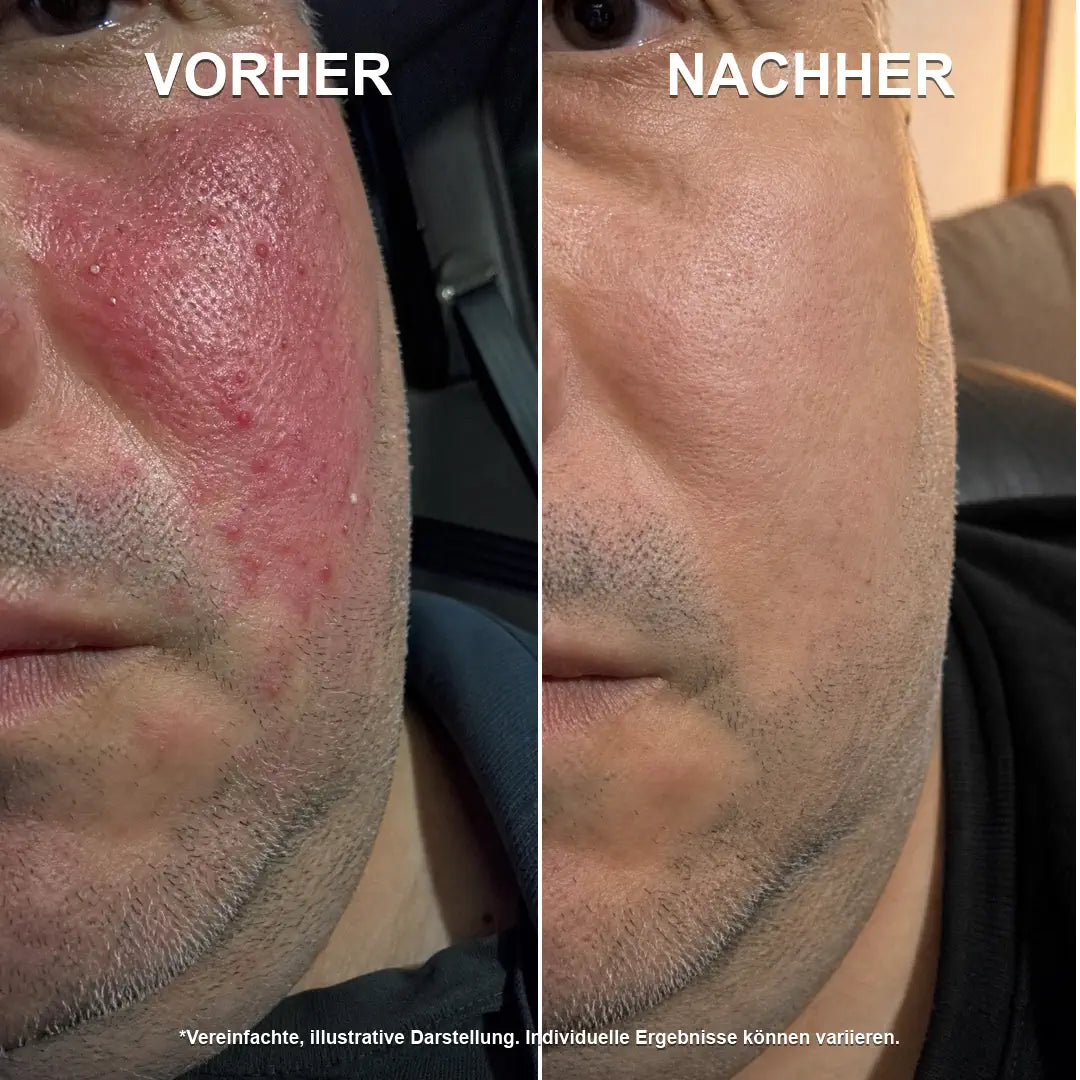 Stoppt Rötungen an der Ursache