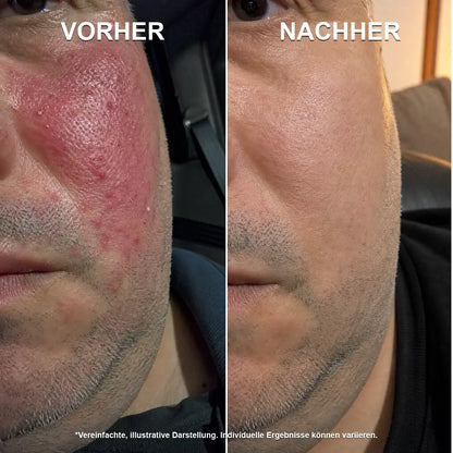 Stoppt Rötungen an der Ursache